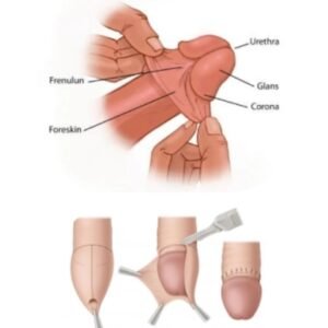 Home circumcision consultation