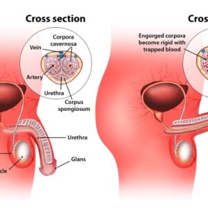 Home erectile dysfunction